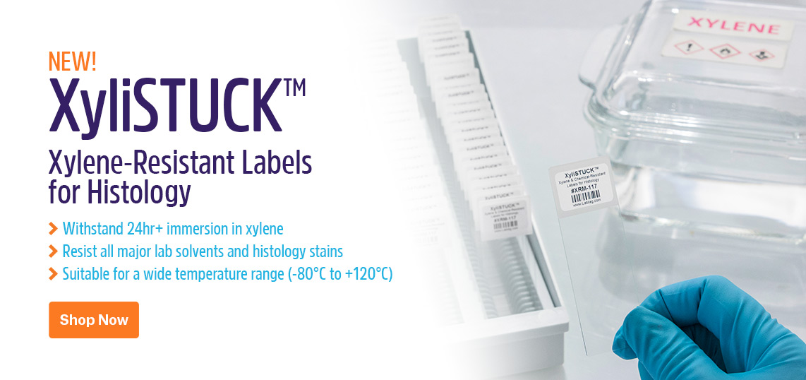 Breakthrough GA International Announces the Launch of XyliSTUCK