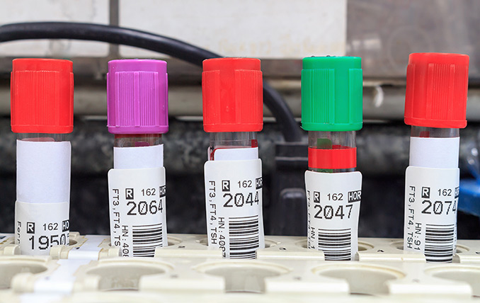 What to do When You Make a Mistake in the Lab - Labtag Blog