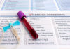 The History Of Cervical Cancer Screening Labtag Blog